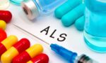 Medible review marijuana can delay onset and prolong survival in als patients