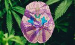 Medible review could hemp derived cbd help patients with traumatic brain injury